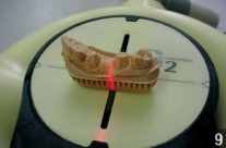 Cup-Articulator – step 9